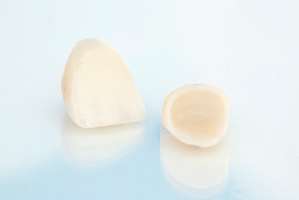 ハイブリッドセラミック