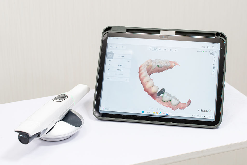 口腔内スキャナー