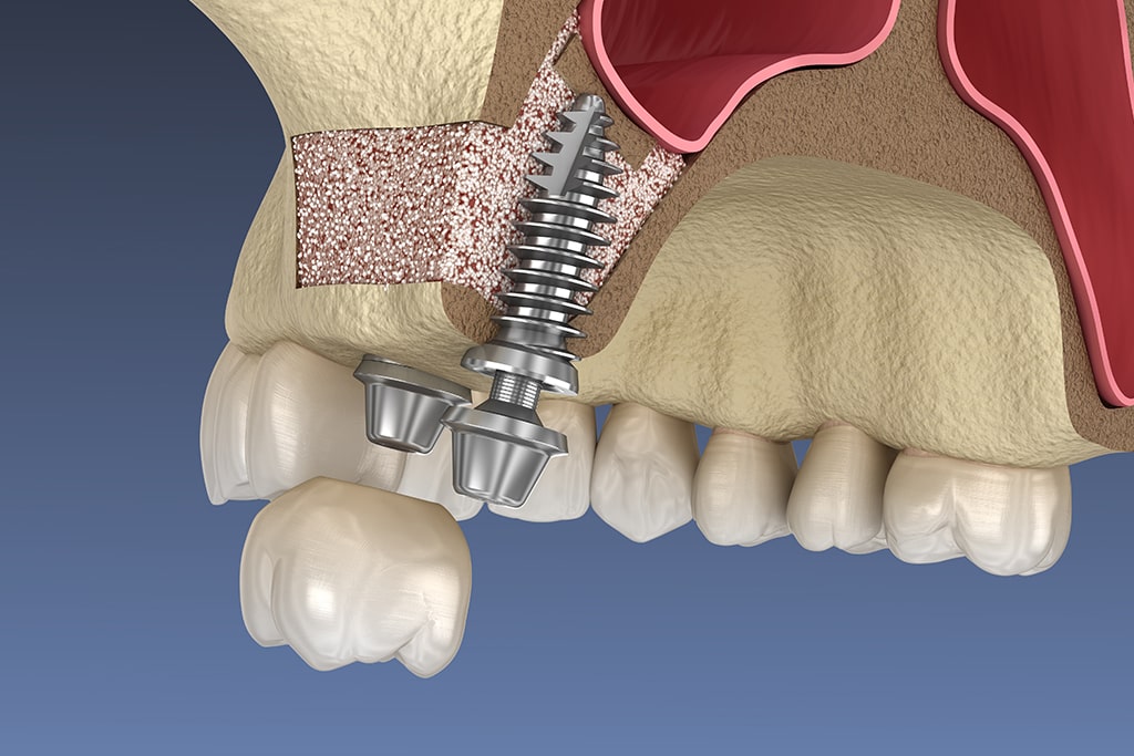 難症例もおまかせください