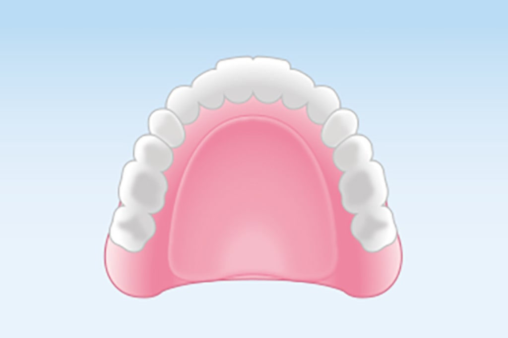 レジン床義歯(保険適用)