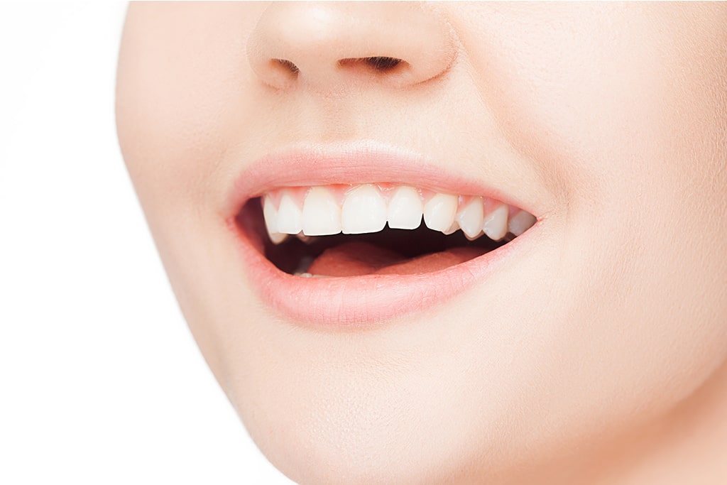 セラミック治療