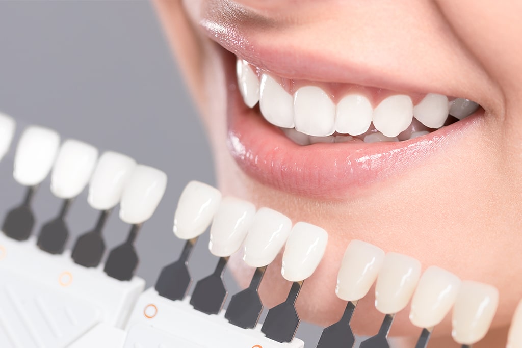 ホワイトニング