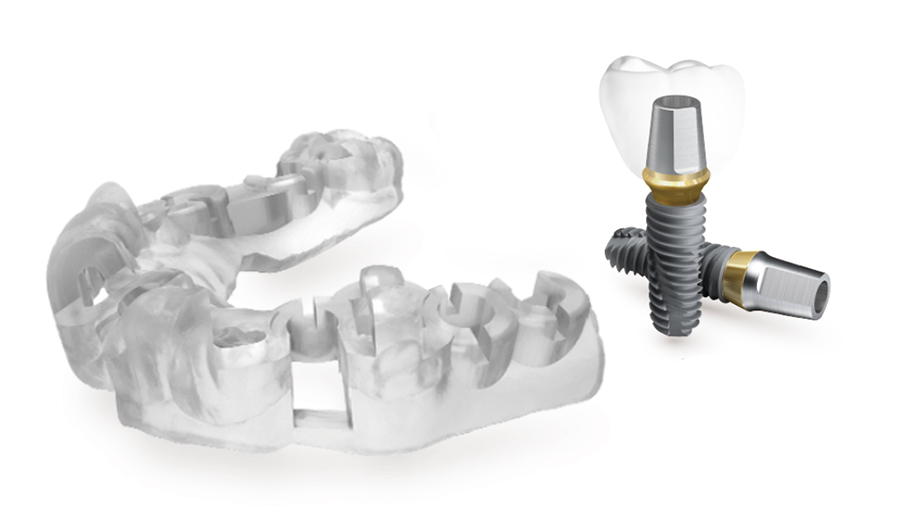 すべての治療でサージカルガイドを使った安全性の高い手術