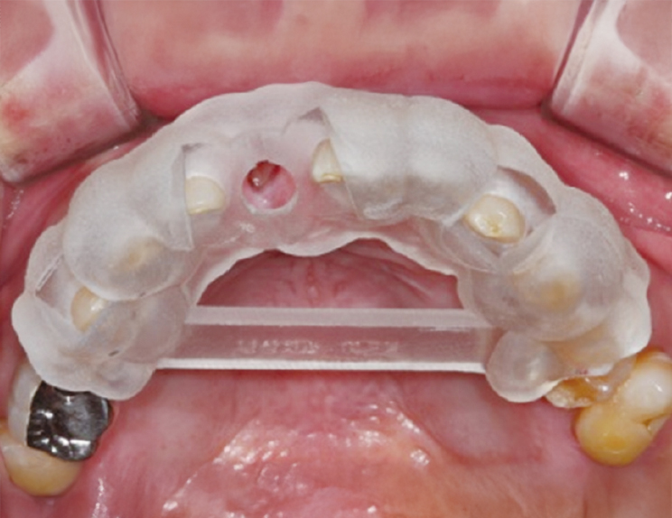 安全性の高い手術